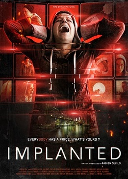 Имплант (Implanted)