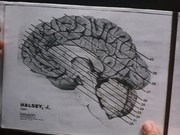 кадр из фильма Мертвый мозг (Brain Dead) - 1